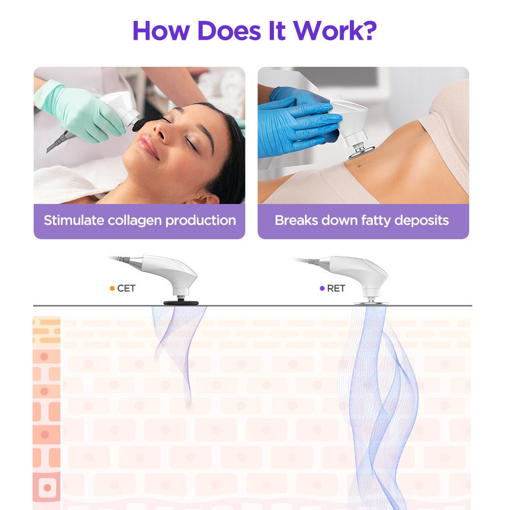 Shape Tactics ElitePro CET RET RF Body Contouring & Rejuvenation System – Cavitation Machines, view 13