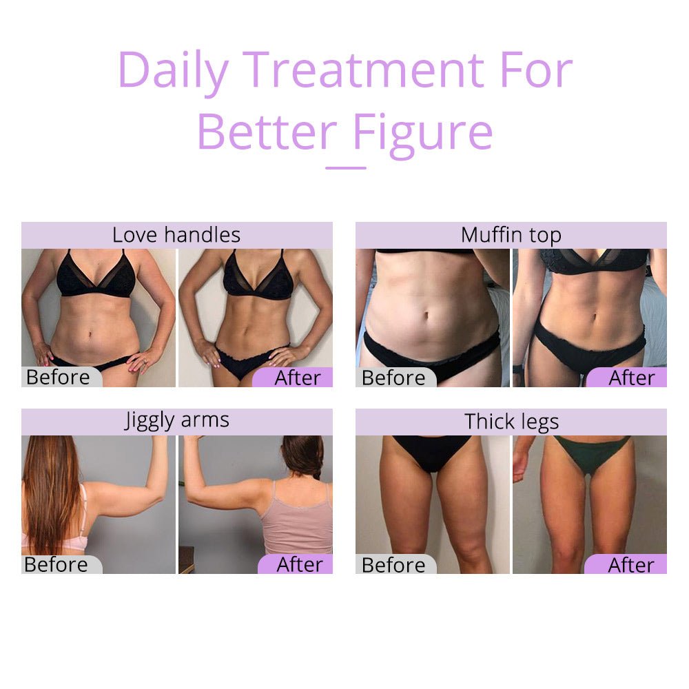 Shape Tactics Unoisetion 2.5 Ultrasonic Cavitation System – Cavitation Machines, view 14