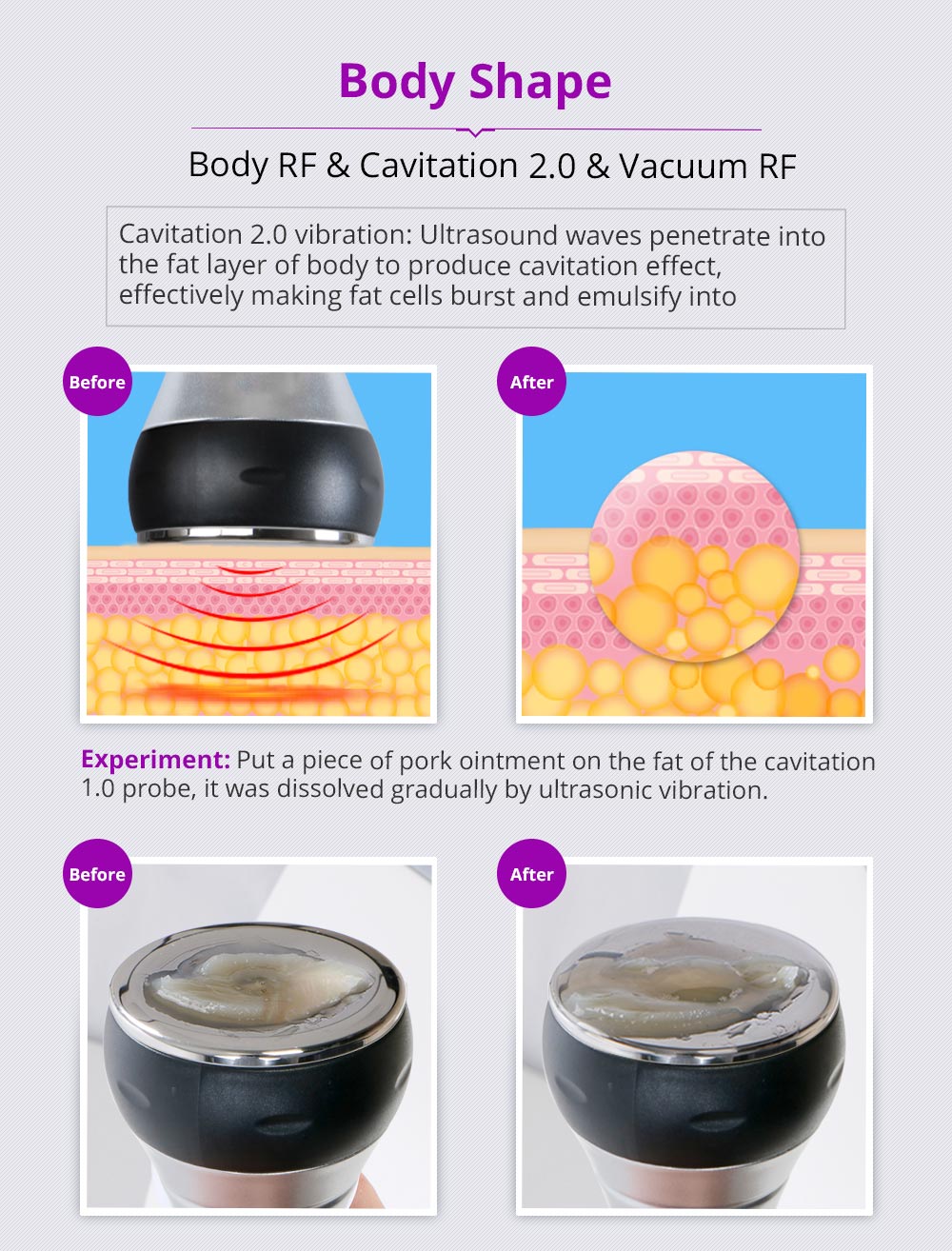 Shape Tactics Unoisetion 40K Cavitation Ultrasound RF Vacuum Photon System – Cavitation Machines, view 9