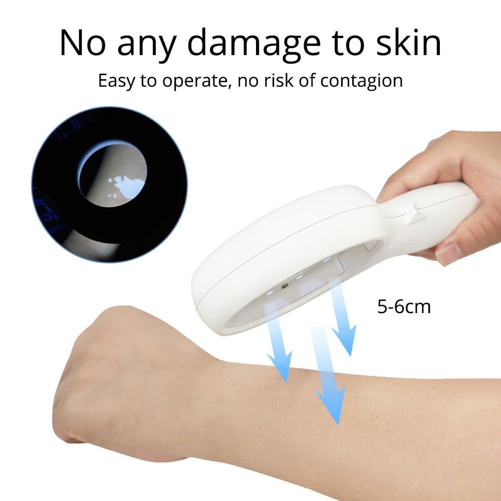 Shape Tactics UV Skin Analyzer Lamp – Cavitation Machines, view 8