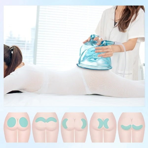 Shape Tactics 21cm Vacuum BBL Suction Therapy Cups – Cavitation Machines, view 5