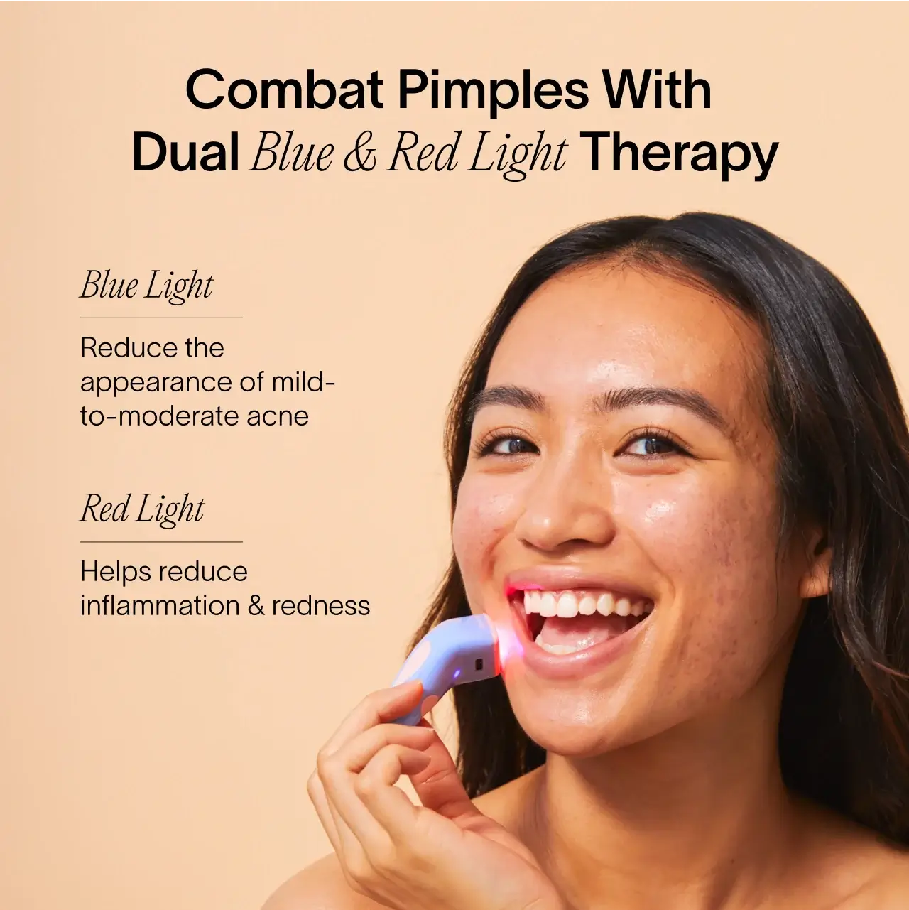Bye Acne: 3-Minute Pimple Spot Treatment – Solawave, view 8