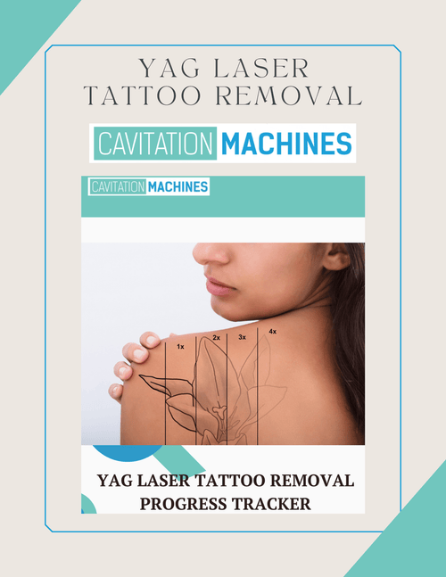 Shape Tactics YAG Laser Tattoo Removal Progress Tracker – Cavitation Machines