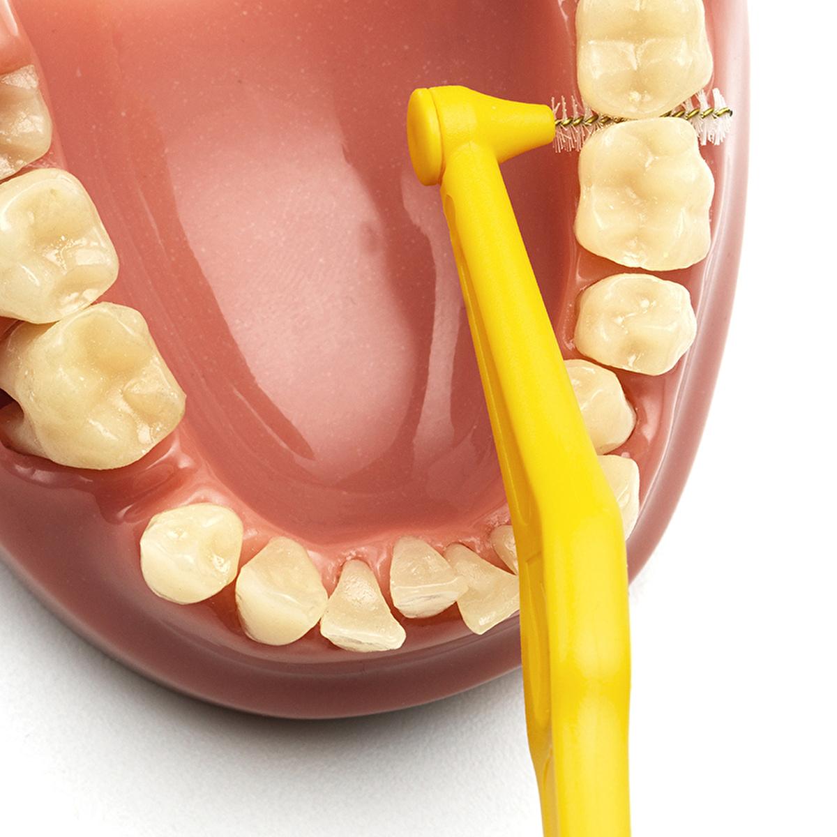 Tepe Angle Interdental Brush 0.7 mm - Effective for Dental Hygiene & Implants